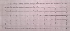 Pomiar ekg na kartce